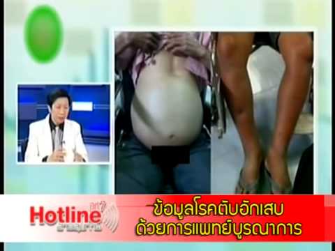 วอลนัทกับสูตรน้ำผึ้งสำหรับความอ่อนแอ การรักษาความอ่อนแอชาย