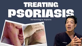 What is Psoriasis? and how to treat it | Dr Davin Lim