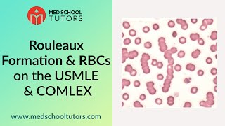 Rouleaux Formation & RBCs on the USMLE