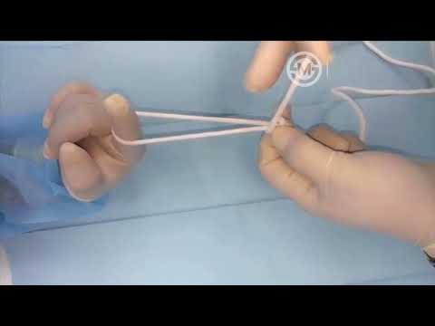 Simple and Safe Extracorporeal Knotting Technique for Laparoscopic Appendectomy