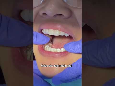 Rahasia ratain gigi tanpa ketauan?😱