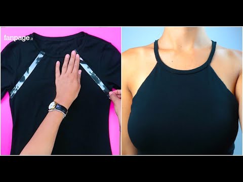 Lentiggini sito ufficiale Ci possono essere posti di pigmentary da un fegato