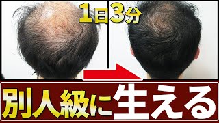 【たったの3分】今日から実践できる薄毛予防の頭皮マッサージ