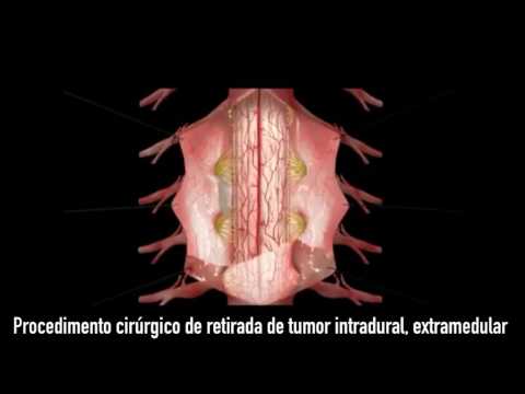 Asana alla divulgazione delle articolazioni della spalla Il dolore della pelle nella parte posteriore