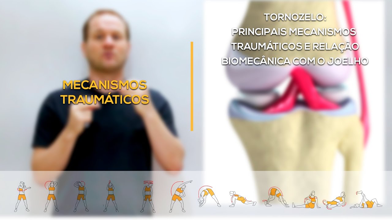 Tornozelo:  Biomecânica dos principais mecanismos traumáticos e correlação com o joelho