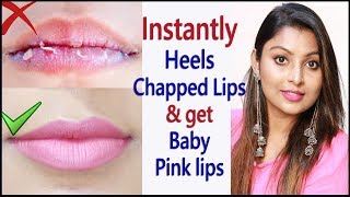 Fast Dark Lips Remove of Women, Baby &amp; Men|| Get Soft &amp; Smooth Pink Lips || chapped lips treatment