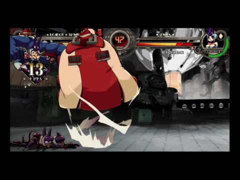 This Is Why Static Hates Me