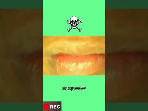 SOPLE - Rugged Blast Ft Blunthed 🔥 (video oficial)