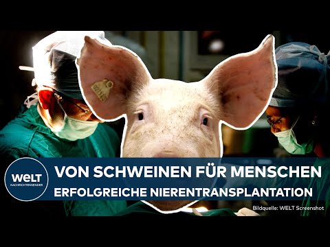 MEDIZINISCHER MEILENSTEIN: Weltweit erster Mensch mit transplantierter Schweineniere
