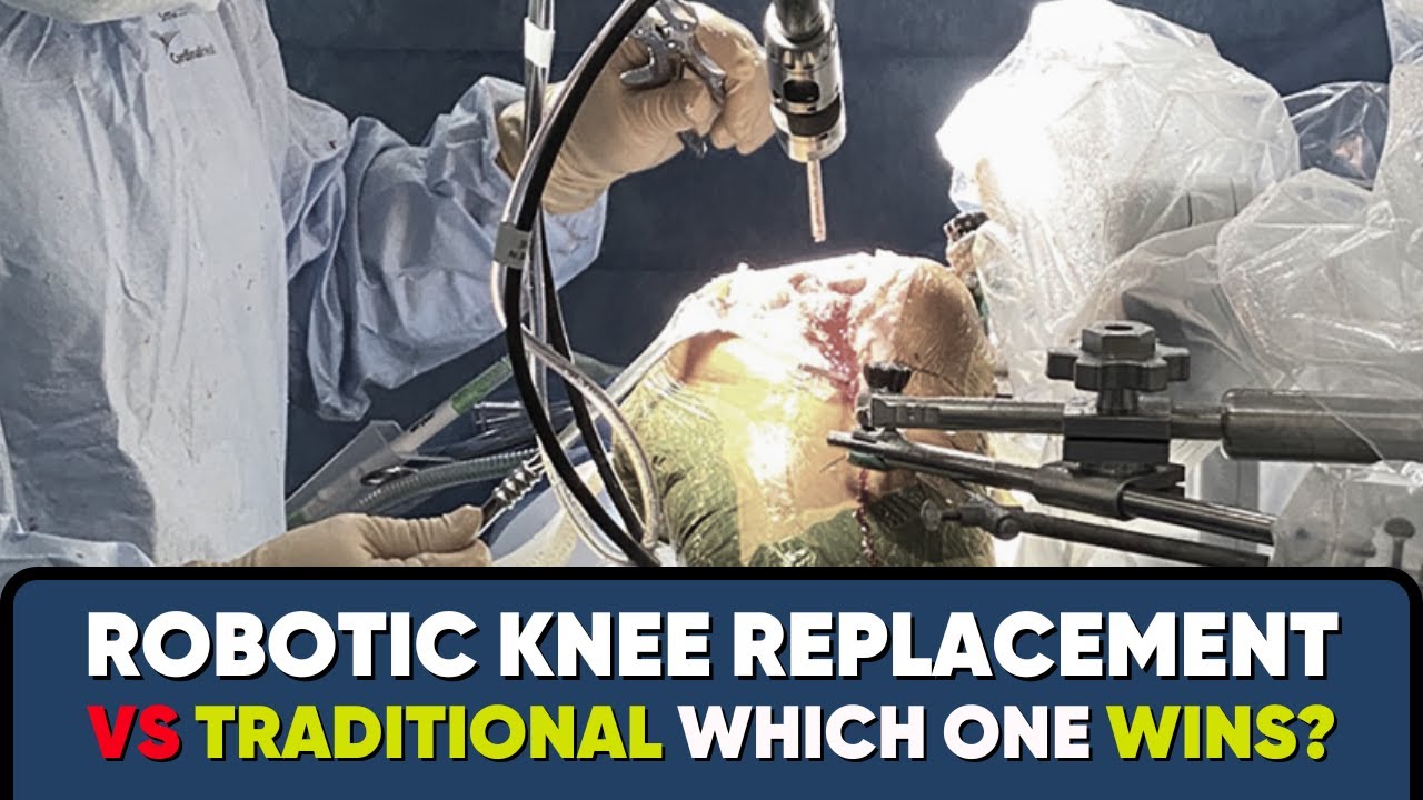 How is Robotic Knee Replacement Done? 2025 updated