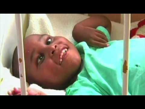 Child Survival & Development 1st 1000 Days of life