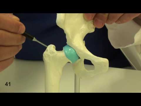 Warum Magen weh tut und gibt an der Taille und ohne monatliche Schwerer Schwindel Therapie in Osteochondrose