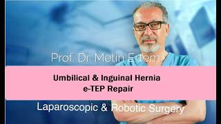 Miniaturka - Laparoscopic e-TEP . Inguinal&Umbilical Hernia. Metin Ertem MD FACS