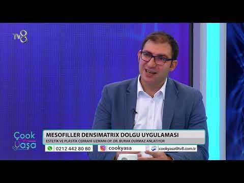 Tv8 Çook Yaşa Programı - Op. Dr. Burak Durmaz - Mesofiller Densimatrix Dolgu Uygulaması