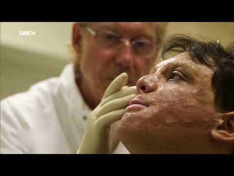 Ramstein-Katastrophe als Vierjähriger überlebt | SWR | Landesschau Rheinland-Pfalz