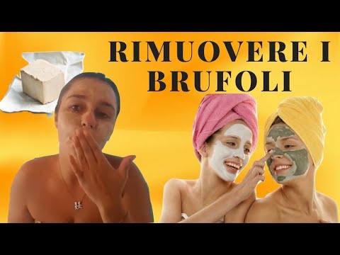 Che i medici trattare una potenza Aumenta la lunghezza dellelemento di ugello ed uno spessore