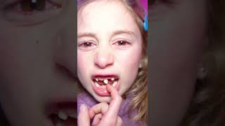 Giorgia ha paura di staccarsi il dente da sola e Papà Salvo l&#39;aiuta! #salvoegiorgia #shorts