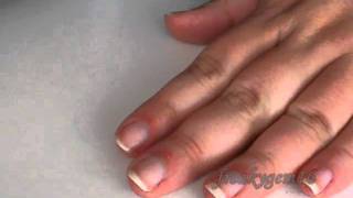 How To Soothe A Hang Nail
