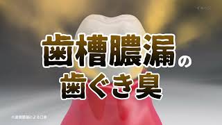 生葉息スーッと実感　ＮＡＣ再改訂「歯ぐき臭」篇Ｄ（S1S-0308）