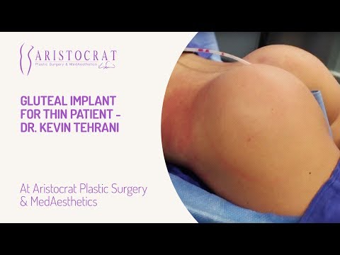 Gluteal Implant for Thin Patient