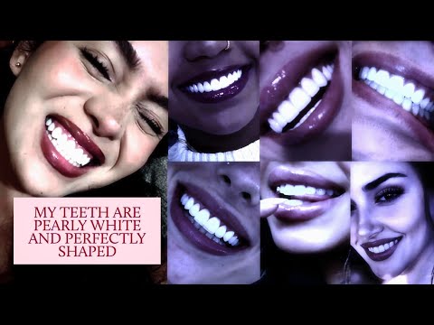 𝐃𝐄𝐍𝐓𝐀𝐋 𝐓𝐑𝐄𝐀𝐓𝐌𝐄𝐍𝐓: ULTRA-WHITE & ALIGNED TEETH