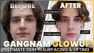 Sofwave & LHALA Peel…