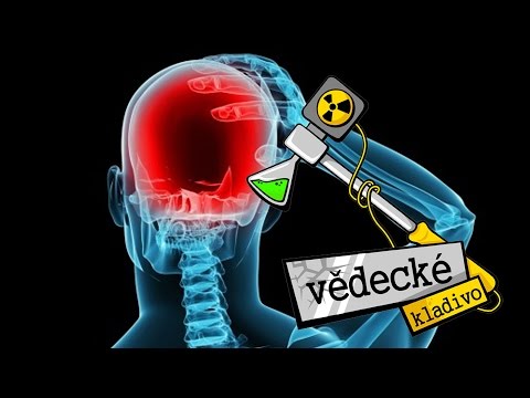 Co je Migréna - Vědecké kladivo