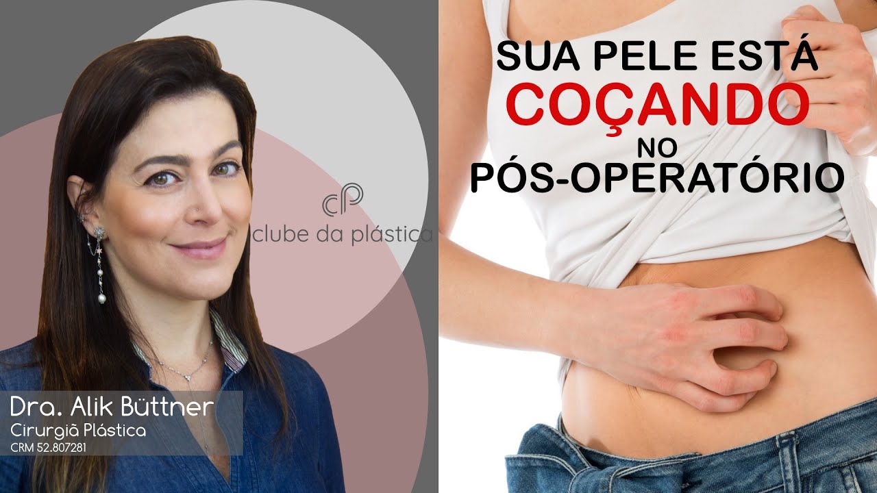 Clube da Plástica: Sua pele está coçando no pós-operatório?