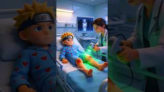 😱 Naruto machucou o joelho?!