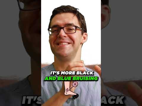 Ankle injury Diagnosis Ankle pain TREATMENT