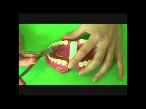 comment traiter grossesse molaire