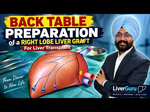 Complete Right Lobe Liver Graft Benching | Back Table Preparation for Living Donor Liver Transplant