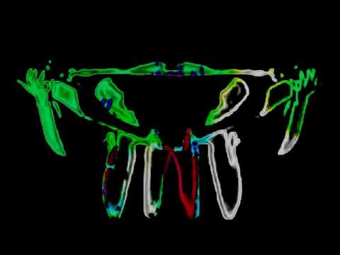 Lake Haze - Her Pale Skin Glowing On The Dancefloor [Shall Not Fade]