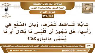 [755 -939] شابة تساقط شعرها، وبان الصلع في رأسها، هل يجوز أن تلبس ما يسمى بالباروكة؟ image