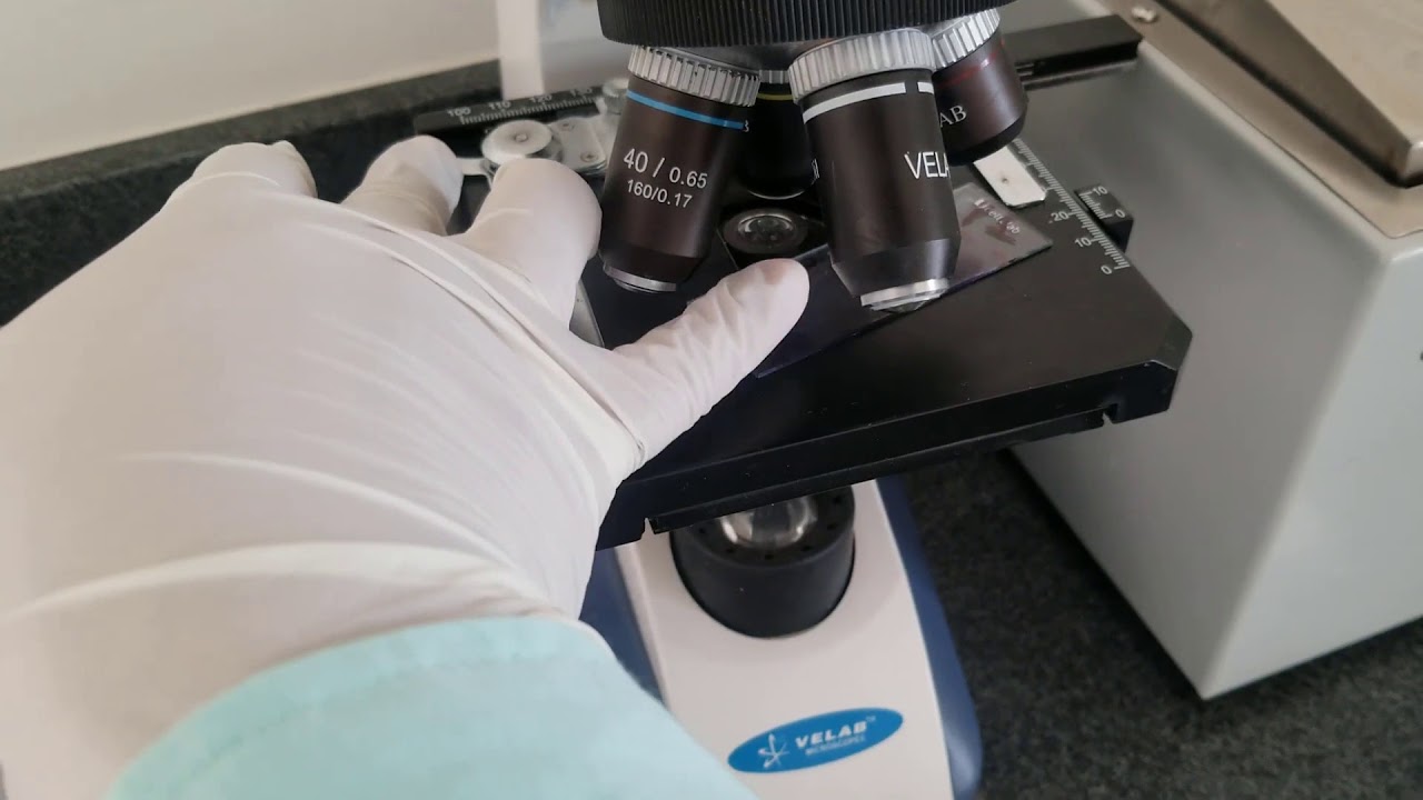 I show the technique to perform a complete blood count!