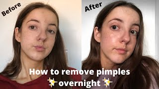 How To Get CLEAR & GLOWY Skin OVERNIGHT (My Skincare Routine)