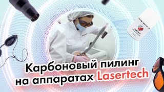 Карбоновый пилинг на аппаратах Lasertech