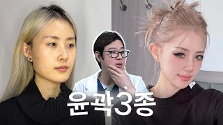 얼굴 작아지는 수술 윤곽 3종 후기｜수술 전후 CT 비교 | 긴얼굴/비대칭 케이스