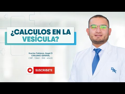 🔍 Cálculos en la Vesícula
