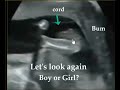 WRONG GENDER!!! BABY ULTRASOUND..  HERE IS WHY ...