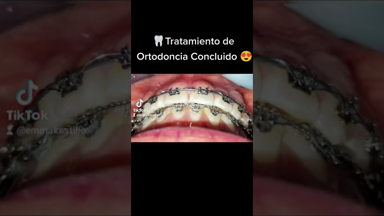 Emma Selenia Hernández Castillo-40