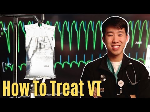 How To Treat VTach / Ventricular Tachycardia - Easy!