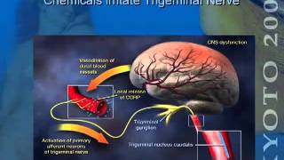 The Wonder Drug Botox