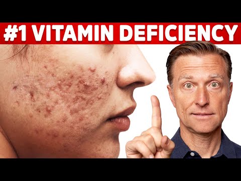 The Top Vitamin Deficiency with Acne
