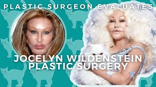 Jocelyn Wildenstein: Plastic Surgery Before And After | Catwoman Evaluated By Plastic Surgeon
