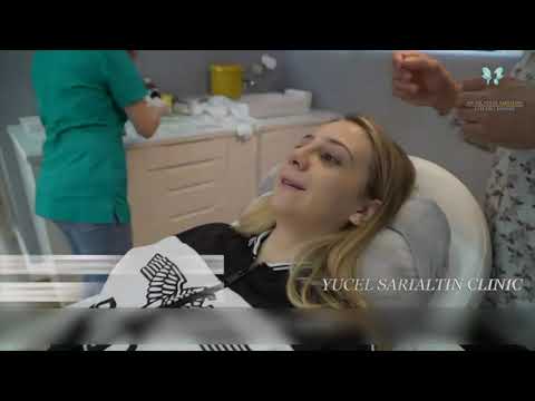 Лоис София (Лондон) Липосакция + Ринопластика