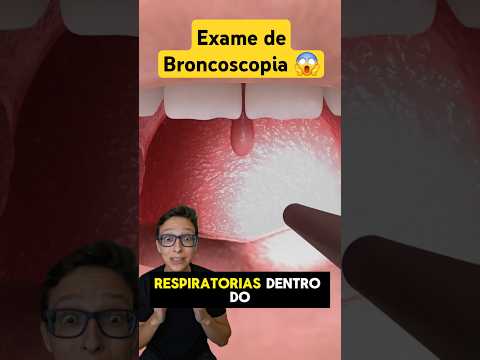 Exame de Broncoscopia 😱 #medicina #medico #curiosidades #enfermagem #enfermeiro #pneumologista