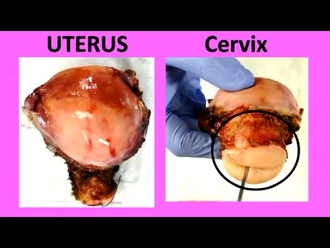 Dysbiosis Schmerz Auf das Bein auf die Knie Ursachen ausstrahlenden Schmerzen