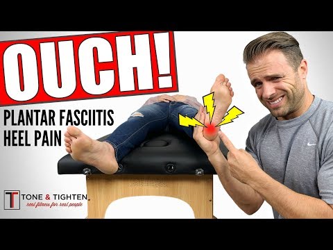 HEEL PAIN GONE How To Treat Plantar Fasciitis At Home