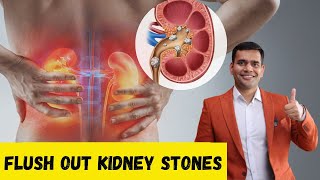 Dissolve  Kidney stones Naturally | Flush Out Kidney Stones - Dr. Vivek Joshi